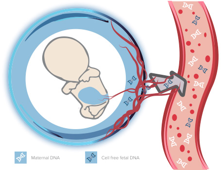 tratamiento-pre-natal-imecife-instituto-de-medicina-y-cirugia-fetal tratamiento-pre-natal-imecife-instituto-de-medicina-y-cirugia-fetal