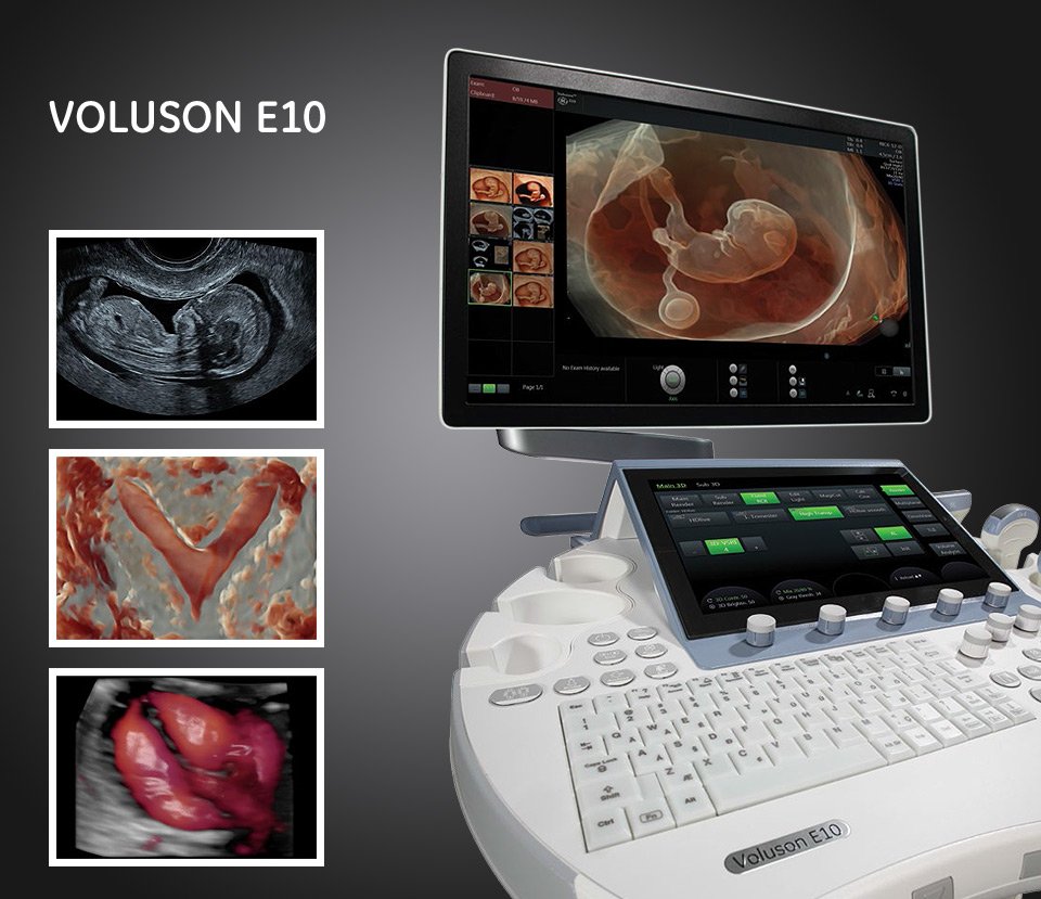 voluson-e10-instituto-peruano-de-medicina-y-cirugia-fetal voluson-e10-instituto-peruano-de-medicina-y-cirugia-fetal